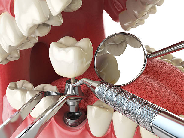 Best Emergency Gum Treatment in Baird, TX
